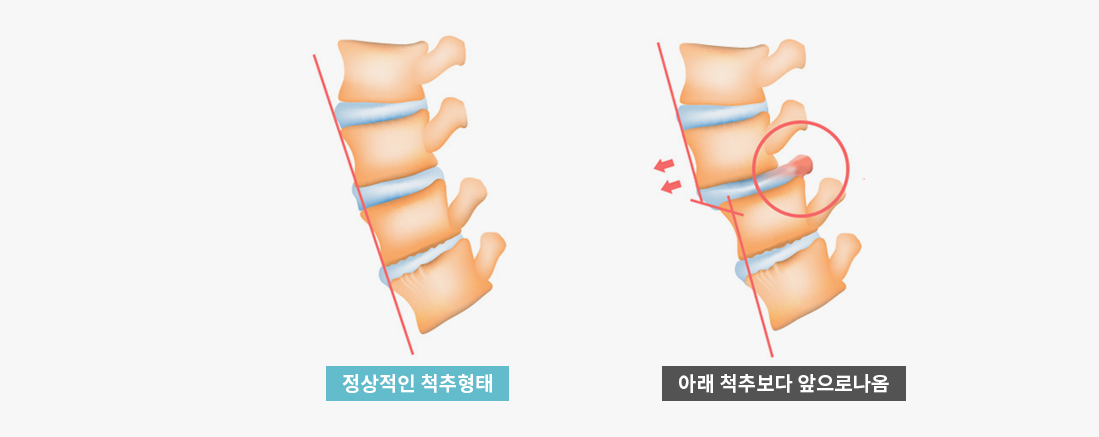 통증재활센터 | 메디그린한방병원